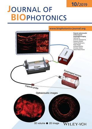 Cover of the Journal of Biophotonics